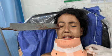 Lesionan con cuchillo a niña en Colombia